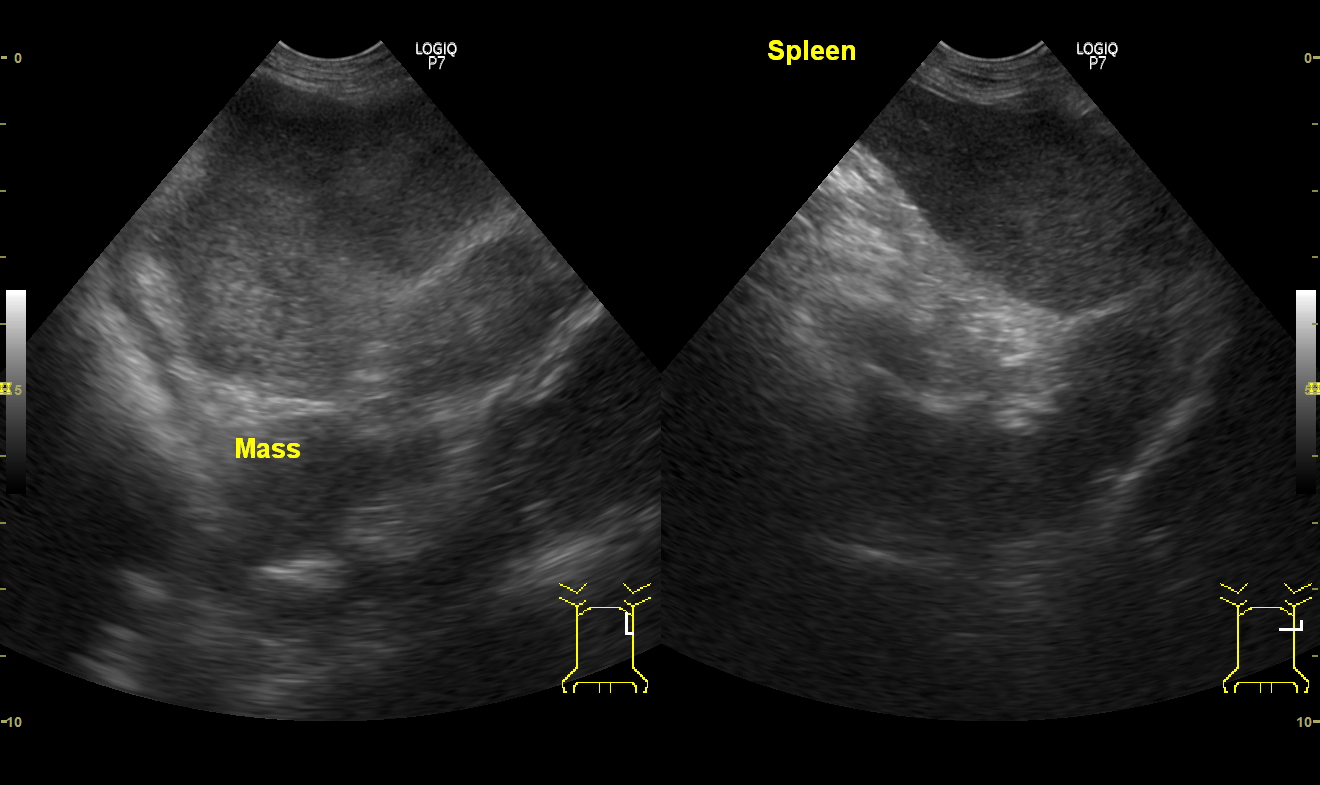 脾臓のリンパ腫（肝脾T細胞型リンパ腫）の症例