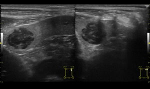 看護師さんのワンちゃんの手術をしました
